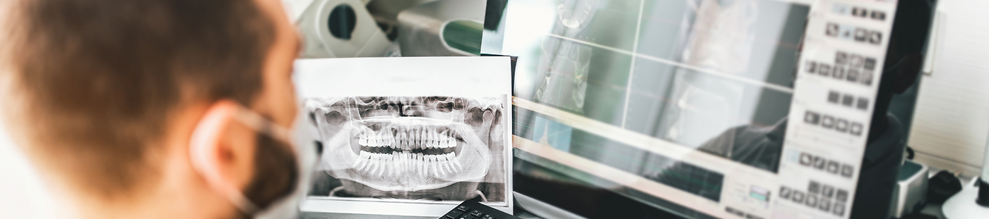 Dentist looking at digital x rays of teeth