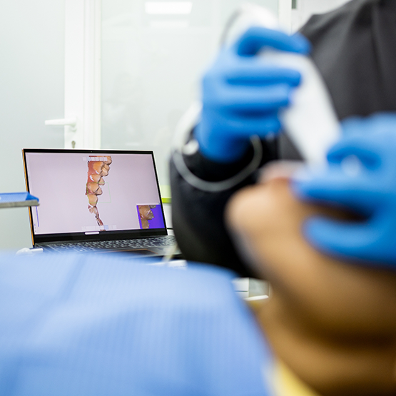 Dental patient having digital impressions taken of their teeth