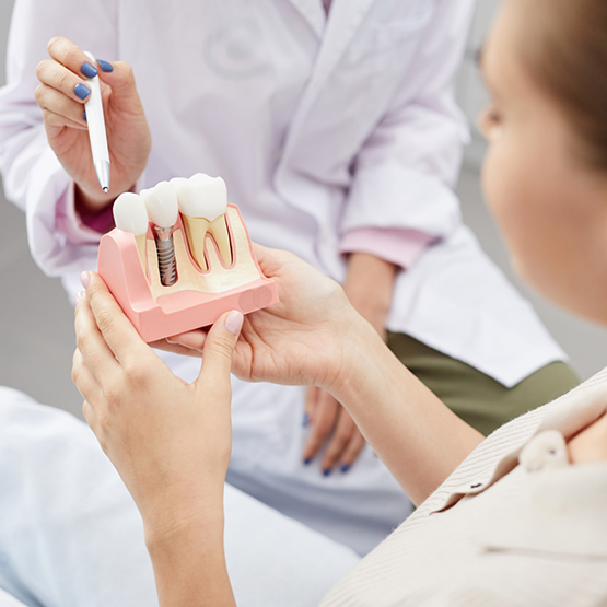 Dentist showing a model of a dental implant to a patient