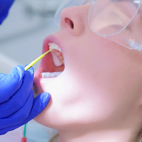 Dental patient having fluoride applied to their teeth