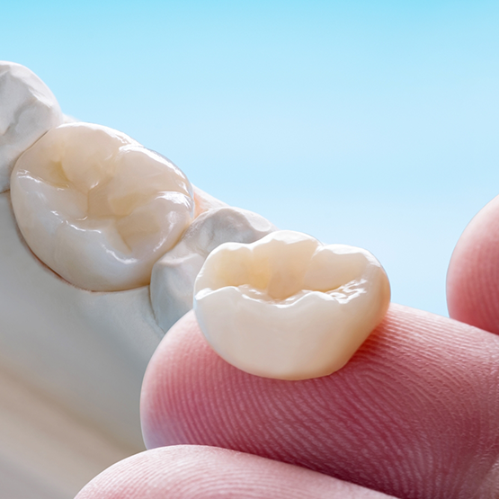 Close up of a dental crown resting on a finger